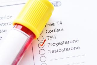 Progesterone Deficiency