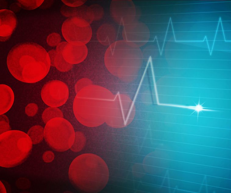 Gout and Metabolic Syndrome
