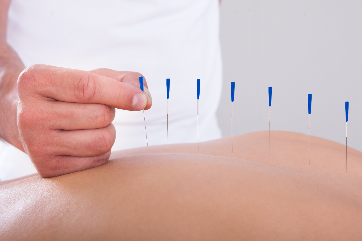 Back Pain and Lumbago - Natural Approaches